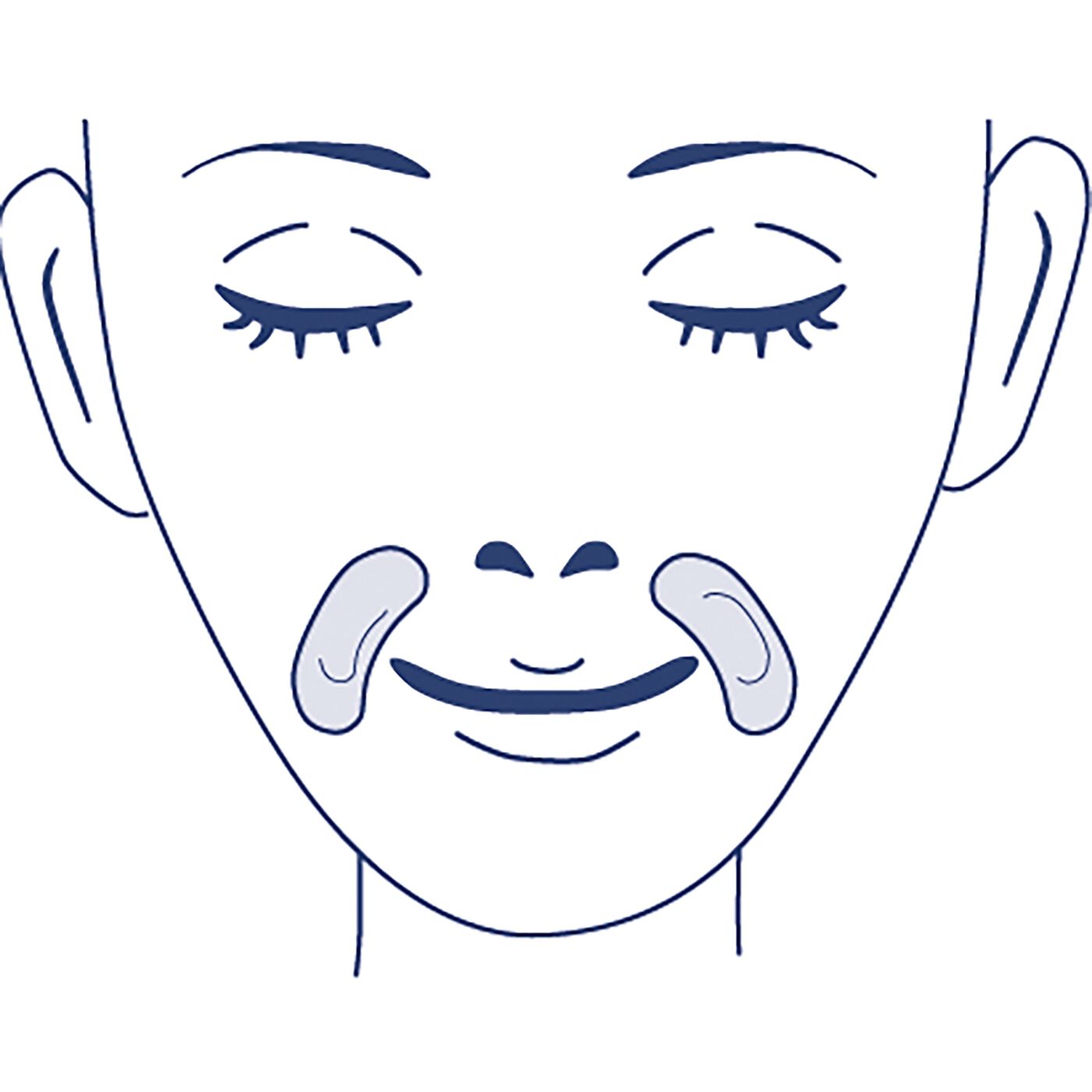 BEAUTY PROJECT|クオニス　ダーマフィラー〈ヒアルロン酸マイクロニードル〉4セット|口もとは鼻から口もとに沿うように軽くおきます。